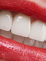 Имплантация зубов – виды и 4 лучших современных способа