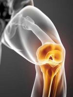 Укрепление костей – лучшие способы после перелома и при остеопорозе