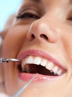 Лечение зубов – 5 современных методов, которые избавят от кариеса