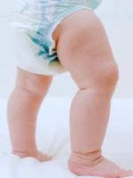 Аллергия на памперсы – как проявляется реакция у малыша, и что делать родителям?
