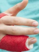 Перелом кисти руки – как распознать и лечить травму?