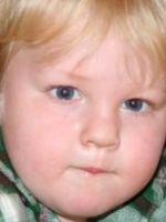 Синдром Прадера-Вилли – чем опасна патология для малыша, и как действовать родителям?