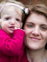 Синдром Тричера-Коллинза – что такое челюстно-лицевой дизостоз, и как можно помочь малышу?