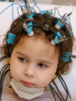 Что показывает ЭЭГ головного мозга у детей, и как проводят обследование?