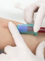 MCHC в анализе крови – что это такое, как определяют показатель, и что на него влияет?
