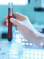 Ревматоидный фактор в анализе крови – для чего и как определяют показатель?