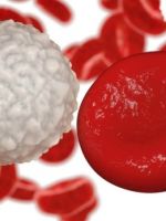 Постгеморрагическая анемия – как найти причину острой и хронической формы и что делать дальше?