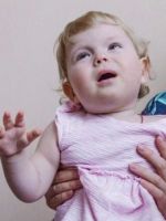 Синдром Ли у ребенка, болезнь Лея – можно ли вылечить патологию?