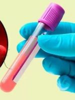 Кровь в сперме – почему появляется гемоспермия, и что делать?