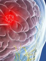 Глиома головного мозга – чем опасна опухоль и сколько с ней живут?