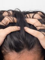 Псориаз на голове – признаки, виды и новое в лечении