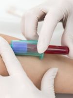 Кровь на ХГЧ – зачем и как сдают анализ?