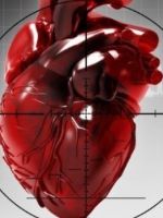 Трансмуральный инфаркт – первая помощь и шансы на выживание