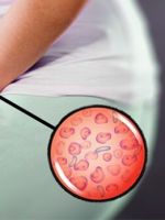 Бактериальный вагинит –  чем грозит болезнь, как ее распознать и лечить?