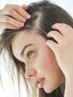 Алопеция – причины тотального, диффузного и очагового выпадения волос