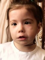 Синдром Мебиуса – какие врачи способны помочь ребенку?