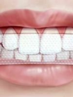 Отбеливающие полоски для зубов – какие выбрать и как их правильно применять?