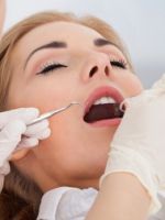 Зубная пломба — как выбирают вид пломбы стоматологи?