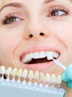 Отбеливание зубов — современные способы и эффективность