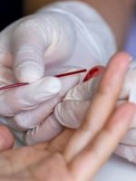 Общий анализ крови – расшифровка и современные обозначения