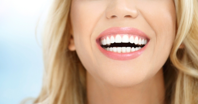 Что такое виниры в стоматологии - сколько стоит красивая улыбка?
