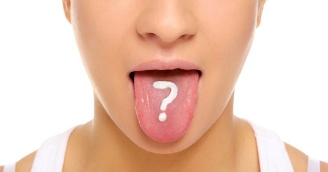 Кандидоз ротовой полости – причины и лечение молочницы во рту