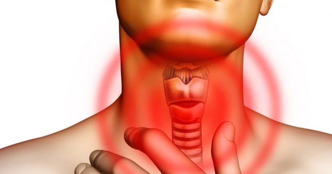 Рак щитовидной железы – симптомы, причины, лечение и прогноз всех видов онкологии