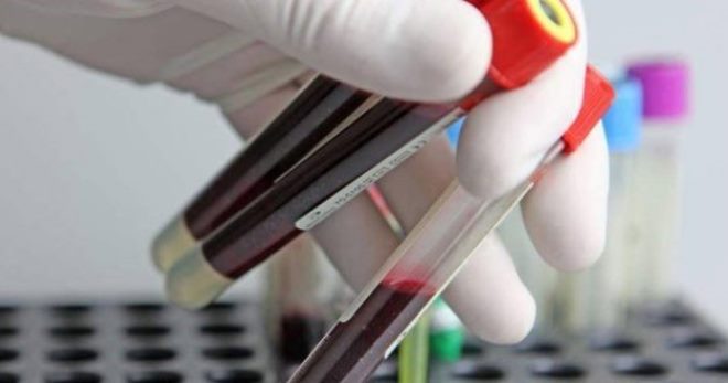 СРБ в крови – что это такое, о чем говорит появление С-реактивного белка?