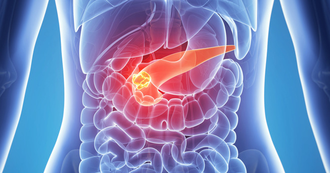 Хронический панкреатит – причины и правильное лечение поджелудочной железы