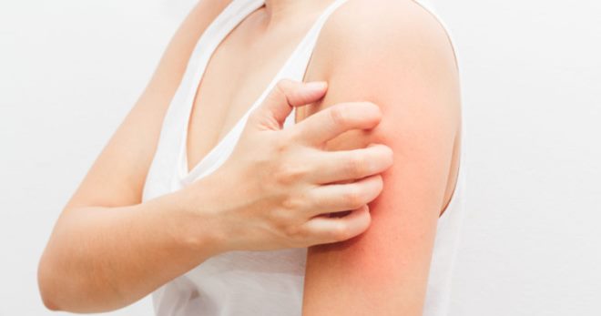 Буллезный дерматит – почему возникает, чем опасен, и как его лечить?