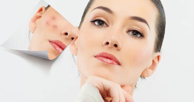 Рубцы от прыщей – виды шрамов на коже и лучшее лечение