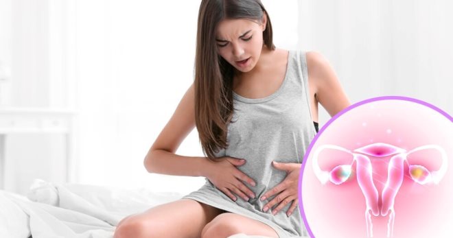 Воспаление яичников у женщин – симптомы и лечение оофорита препаратами и народными средствами