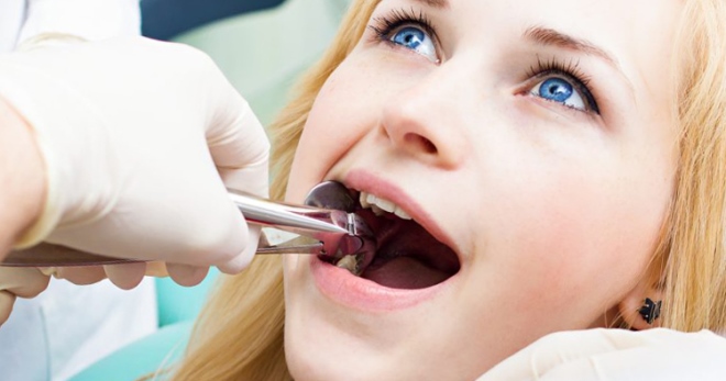 Ретинированный зуб – признаки и современные методы лечения