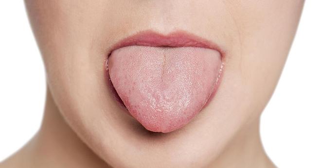 Красный плоский лишай в полости рта – самое эффективное лечение