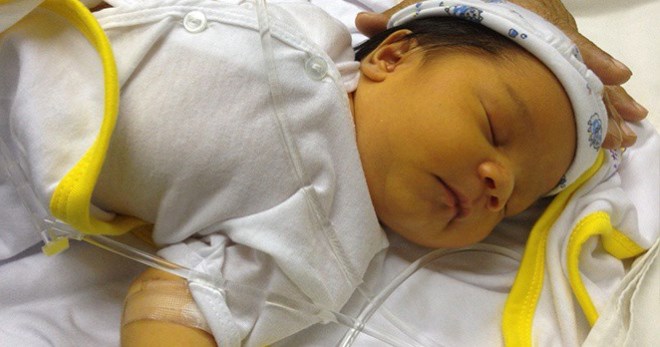 Желтушка у новорожденных – причины и последствия физиологического и патологического пожелтения кожи