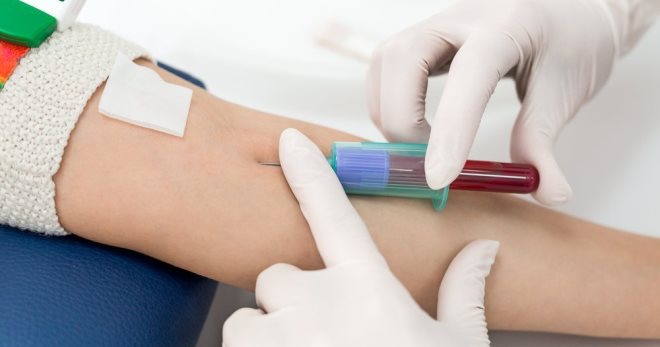 Кровь на ХГЧ – зачем и как сдают анализ?