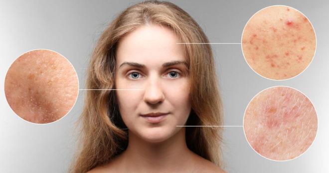 Заболевания кожи лица – 7 видов патологий