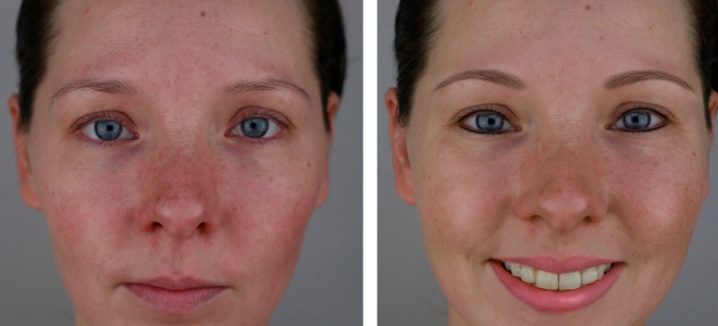 перманентный макияж век фото до и после 3