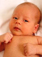 Кривошея у ребенка 3 месяца – симптомы