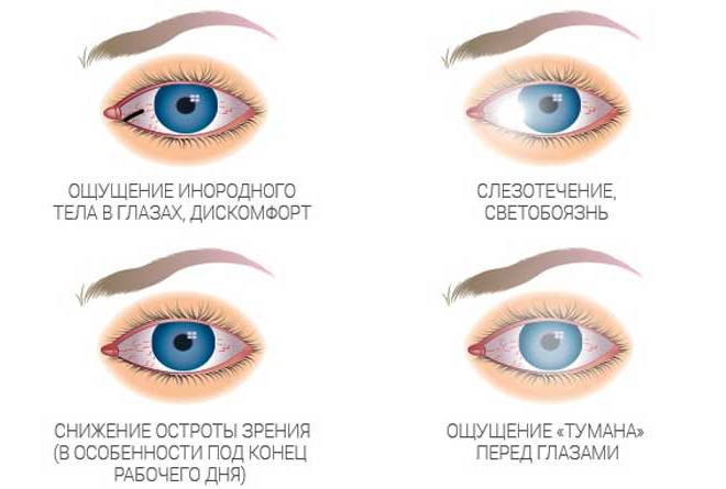 синдром сухого глаза симптомы