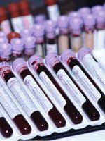 Анализ крови при онкологии