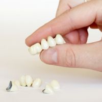 пластмассовые коронки на жевательные зубы