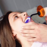 пломбирование зуба
