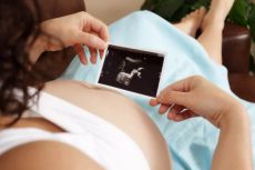 как гинекологи считают недели беременности