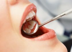 этапы протезирования зубов металлокерамикой