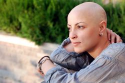 всегда ли выпадают волосы после химиотерапии