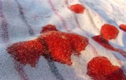 Как отмыть кровь с одежды