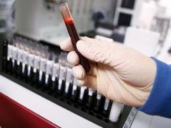 анализ крови на цитомегаловирус