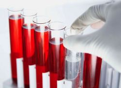 биохимический анализ крови фибриноген норма