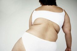 диета при ожирении 3 степени